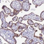 CRB2 Antibody in Immunohistochemistry (Paraffin) (IHC (P))