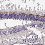 CRB2 Antibody in Immunohistochemistry (IHC)