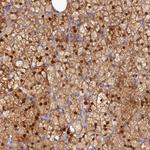 SPATA5L1 Antibody in Immunohistochemistry (Paraffin) (IHC (P))