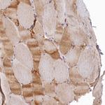 SPATA5L1 Antibody in Immunohistochemistry (Paraffin) (IHC (P))