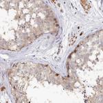 SPATA5L1 Antibody in Immunohistochemistry (Paraffin) (IHC (P))