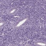 CABP5 Antibody in Immunohistochemistry (Paraffin) (IHC (P))