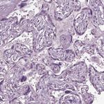 CABP5 Polyclonal Antibody