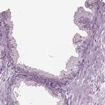 CABP5 Antibody in Immunohistochemistry (Paraffin) (IHC (P))