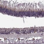 CABP5 Antibody in Immunohistochemistry (IHC)