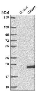 CABP5 Antibody in Western Blot (WB)