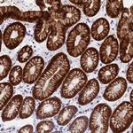 ZNF181 Polyclonal Antibody