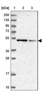 ZNF181 Antibody in Western Blot (WB)