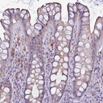 NAT1 Polyclonal Antibody