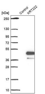Krt222 Antibody in Western Blot (WB)