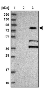 KBTBD7 Antibody in Western Blot (WB)