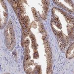 ARL16 Polyclonal Antibody