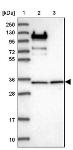 RPL5 Antibody in Western Blot (WB)