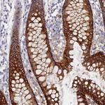 TMEM44 Antibody in Immunohistochemistry (Paraffin) (IHC (P))