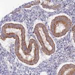 TMEM44 Antibody in Immunohistochemistry (Paraffin) (IHC (P))