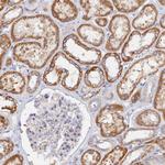 TMEM44 Antibody in Immunohistochemistry (Paraffin) (IHC (P))