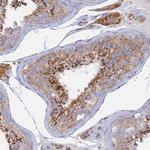 TMEM44 Antibody in Immunohistochemistry (Paraffin) (IHC (P))