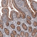 FASTKD1 Antibody in Immunohistochemistry (IHC)