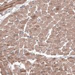FASTKD1 Antibody in Immunohistochemistry (IHC)