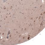 FASTKD1 Antibody in Immunohistochemistry (IHC)