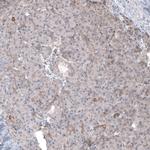 FASTKD1 Polyclonal Antibody