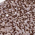 MGAT2 Polyclonal Antibody