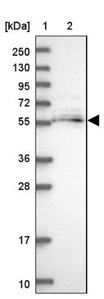 MGAT2 Antibody in Western Blot (WB)