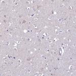 PTPRCAP Antibody in Immunohistochemistry (Paraffin) (IHC (P))