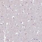 PTPRCAP Antibody in Immunohistochemistry (IHC)