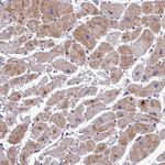 Adiponectin Receptor 2 Antibody in Immunohistochemistry (Paraffin) (IHC (P))