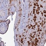 Adiponectin Receptor 2 Antibody in Immunohistochemistry (Paraffin) (IHC (P))