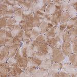 Adiponectin Receptor 2 Antibody in Immunohistochemistry (Paraffin) (IHC (P))