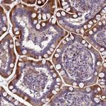 Adiponectin Receptor 2 Polyclonal Antibody