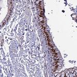 CLK4 Antibody in Immunohistochemistry (Paraffin) (IHC (P))