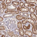 RANBP6 Antibody in Immunohistochemistry (IHC)