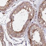 RANBP6 Antibody in Immunohistochemistry (IHC)