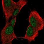 CRYBB2 Polyclonal Antibody