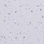 CRYBB2 Antibody in Immunohistochemistry (Paraffin) (IHC (P))