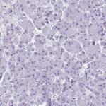 CRYBB2 Antibody in Immunohistochemistry (Paraffin) (IHC (P))