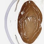 CRYBB2 Antibody in Immunohistochemistry (IHC)