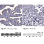 C5orf49 Polyclonal Antibody
