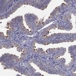C5orf49 Antibody in Immunohistochemistry (IHC)