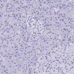 PRPS1 Antibody in Immunohistochemistry (Paraffin) (IHC (P))