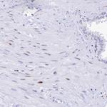 PRPS1 Antibody in Immunohistochemistry (Paraffin) (IHC (P))