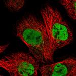 DPY30 Polyclonal Antibody