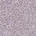 DPY30 Antibody in Immunohistochemistry (IHC)
