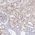 DPY30 Antibody in Immunohistochemistry (IHC)
