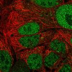 APOA1BP Polyclonal Antibody