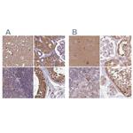 APOA1BP Antibody in Immunohistochemistry (IHC)