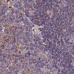APOA1BP Antibody in Immunohistochemistry (IHC)